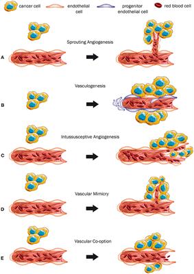 Different Forms of Tumor Vascularization and Their Clinical Implications Focusing on Vessel Co-option in Colorectal Cancer Liver Metastases